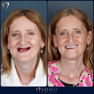 Slider image (4) Soho Dental Clinic